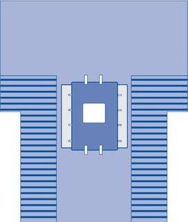 Medline DYNJP3102A Sterile Laparoscopic Cholecystectomy Drape with Troughs
